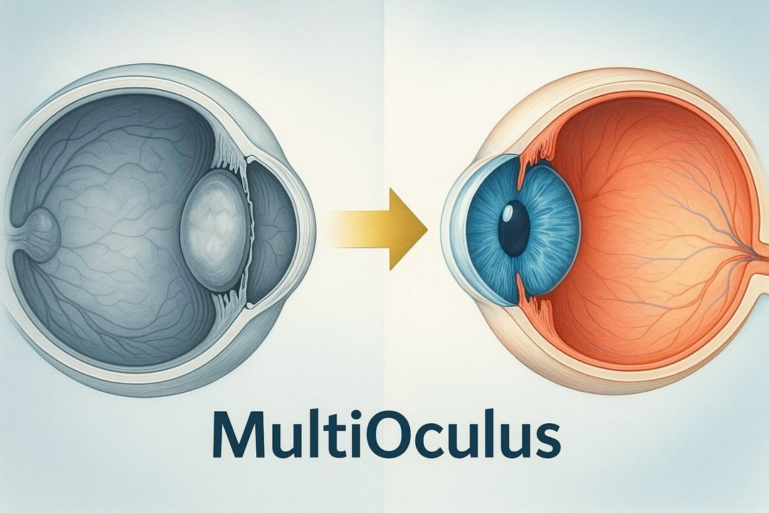 Программа «Мульти-Окулус»