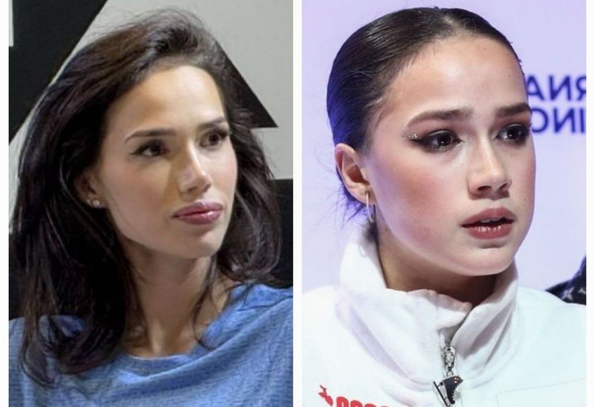 Но публичная жизнь не про спокойствие. Любое движение, любое изменение внешности мгновенно становится предметом обсуждения. А когда речь идет о девушке, за которой следят миллионы, давление увеличивается в разы.
