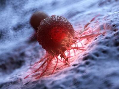    Исследователи научились выявлять раковые клетки на самых ранних стадиях