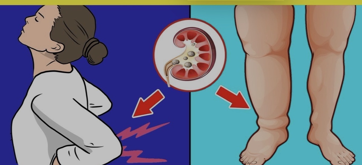 главные факторы риска