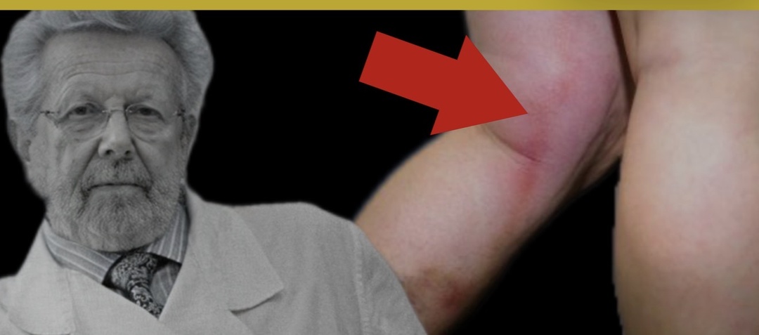 Антикоагулянты и тромбы: почему одной таблетки недостаточно