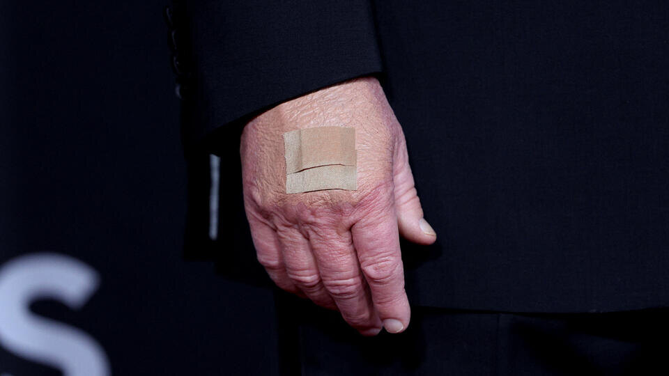     Трамп назвал причину появления синяков на его руках REUTERS/Tom Brenner