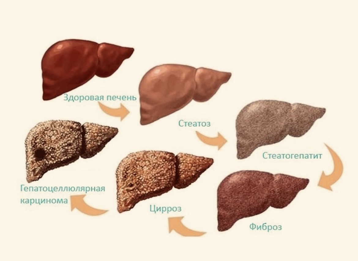 Яндекс фото. 