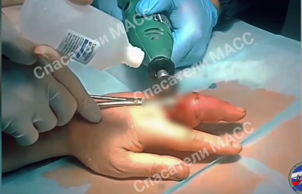    Фото: Спасатели МАСС