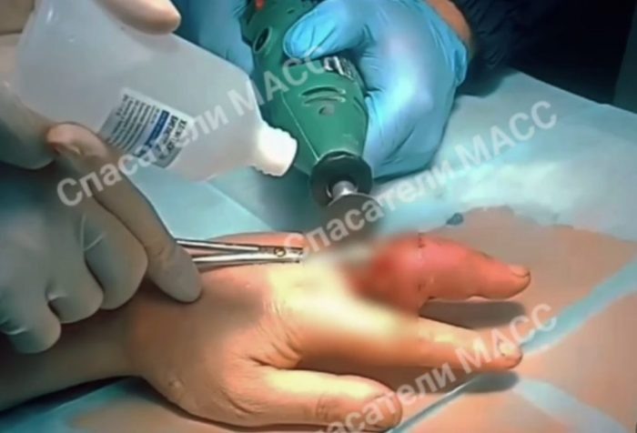 Фото телеграм-канала «СПАСАТЕЛИ МАСС».