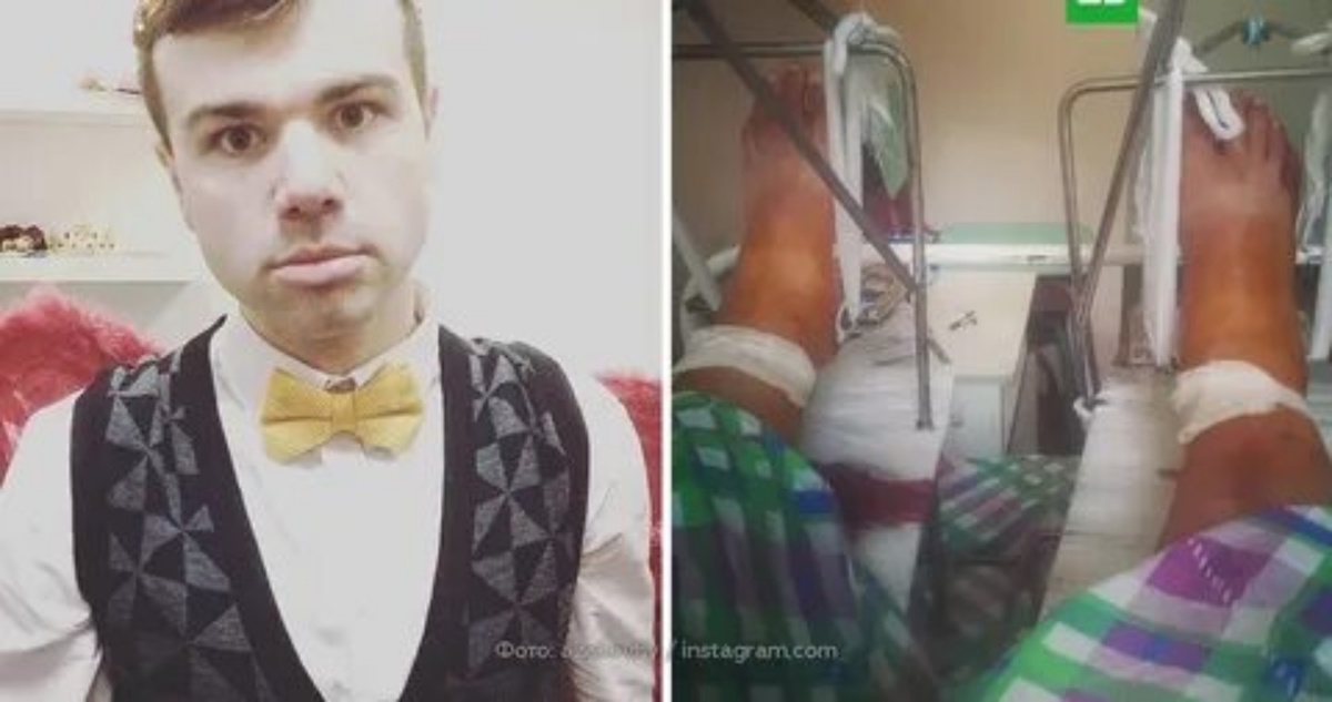 Врачи собирали его ноги по частям. 22 перелома и 1500 осколков — цена одного неверного шага на пожарной лестнице.