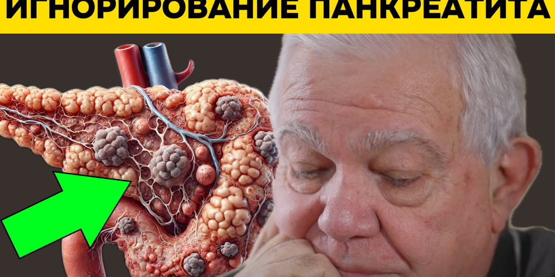 Живут ли с панкреатитом 50 лет? Ответы науки и врачей