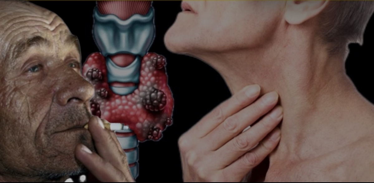 Щитовидная железа — дирижер метаболизма