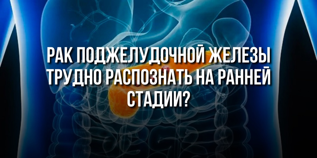 Рак поджелудочной железы: почему его трудно распознать на ранней стадии?