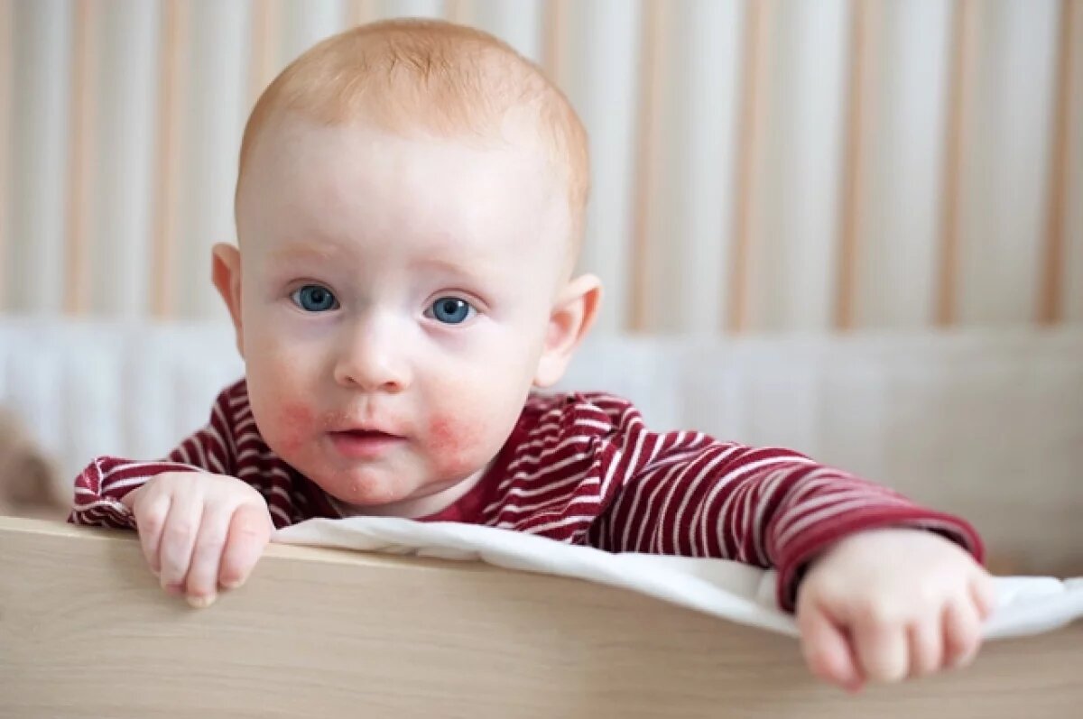    Дерматолог Макарычев объяснил, почему зимой обостряются заболевания кожи