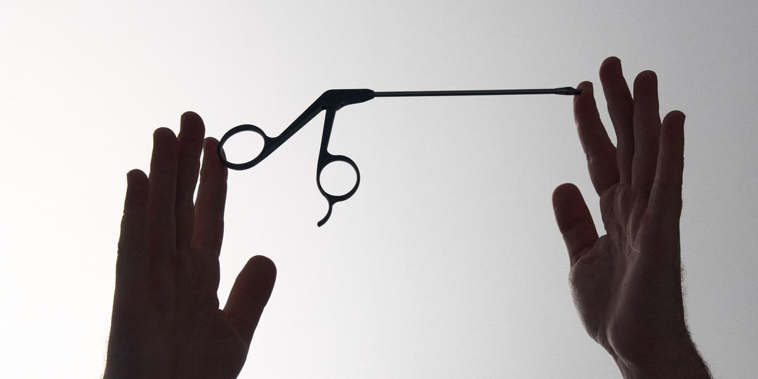 Артроскопия (разрыв мениска).