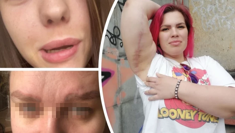 Жертвы новосибирских косметологов рассказали свои истории.
"КП-Новосибирск"