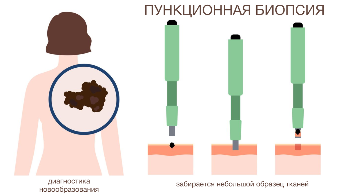 Гистология – это анализ взятых (как правило, в процессе биопсии) у пациента тканей под микроскопом