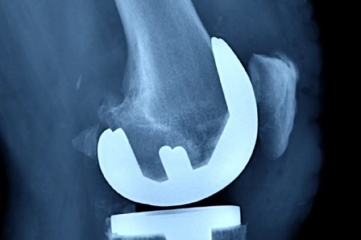    Титулованному самбисту Кочугову провели операцию в Нижнем Новгороде