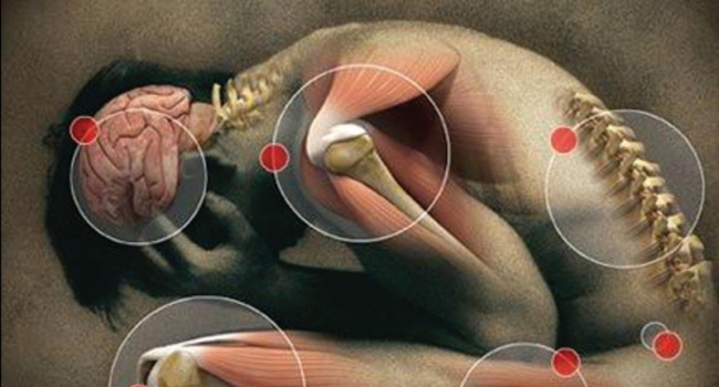 Нейропатическая боль: если тело “кричит” без причины - как распознать сбой нервной системы и остановить его