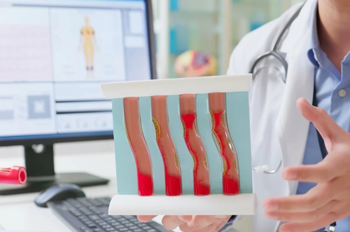    Чтобы защитить свои сосуды, необходимо будет пройти диспансеризацию.