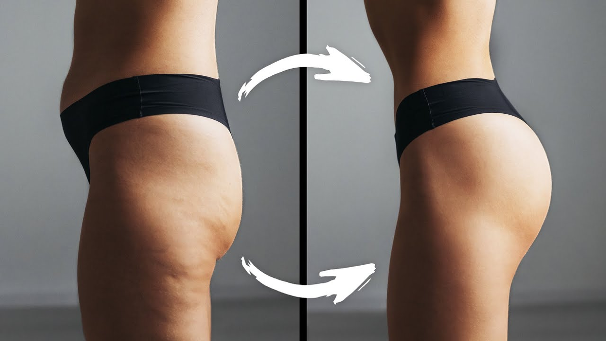 Слабые ягодицы разрушают позвоночник