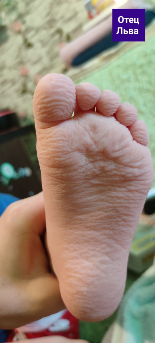 Ножка Льва после процедуры прогревания.