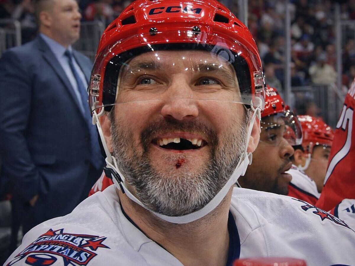    Овечкин получил клюшкой в лицо и лишился еще одного зуба | © Фото : LoyalCaps/соцсеть X