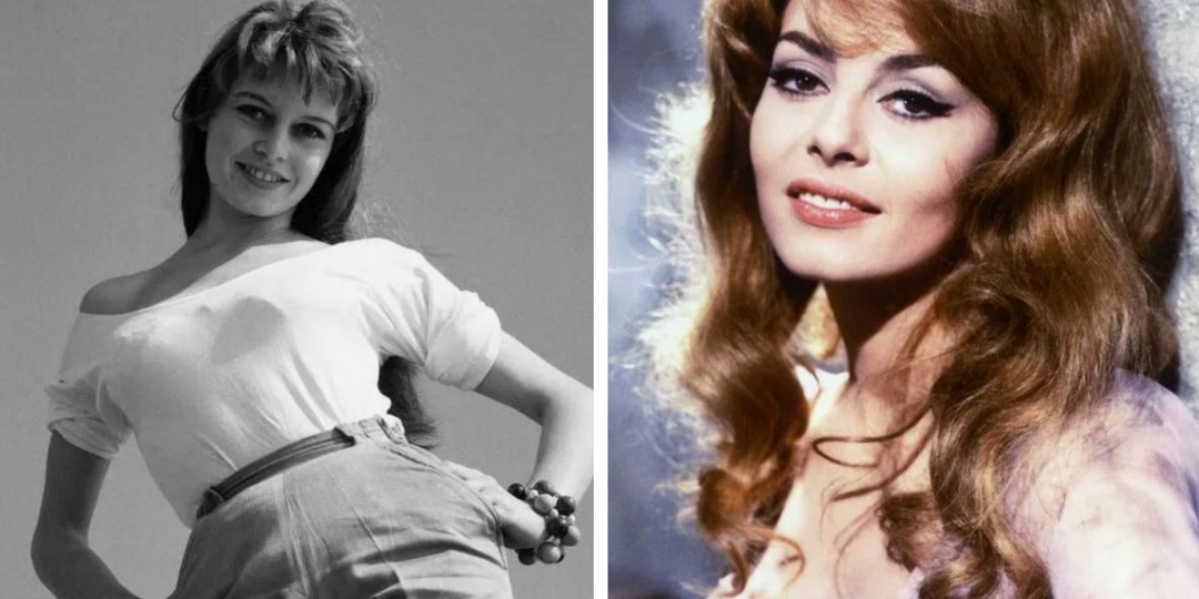 Мир считал их идеальными, а они - нет: 5 красивых женщин, которым не нравилась своя внешность