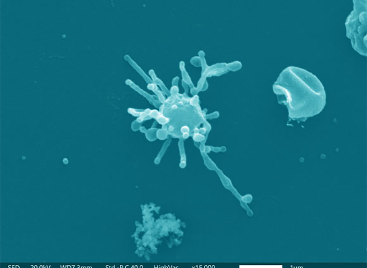 Асгард-археи - генетические предки эукариот