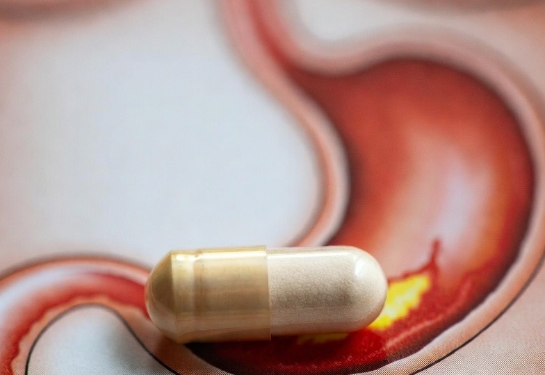 Омепразол и язвы: что ответили врачи?