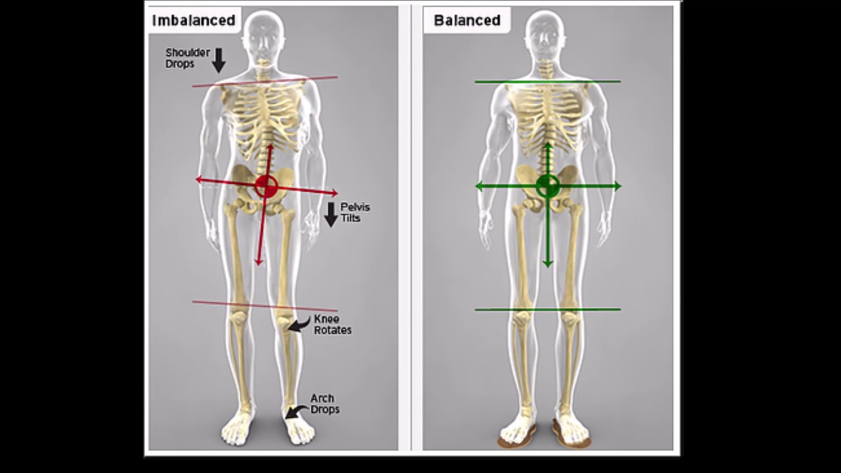 Лицо стареет от таза и стоп. Как стопы и таз влияют на лицо