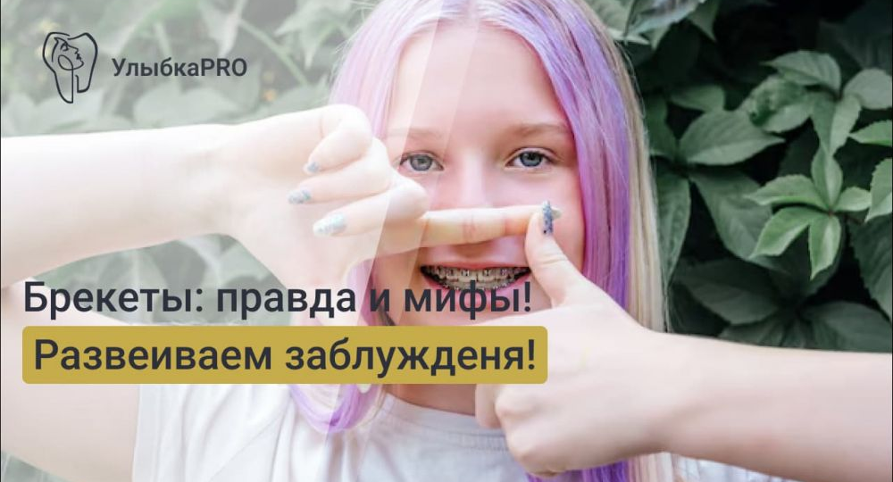 Брекеты: мифы и реальность. Развенчиваем заблуждения о лечении
