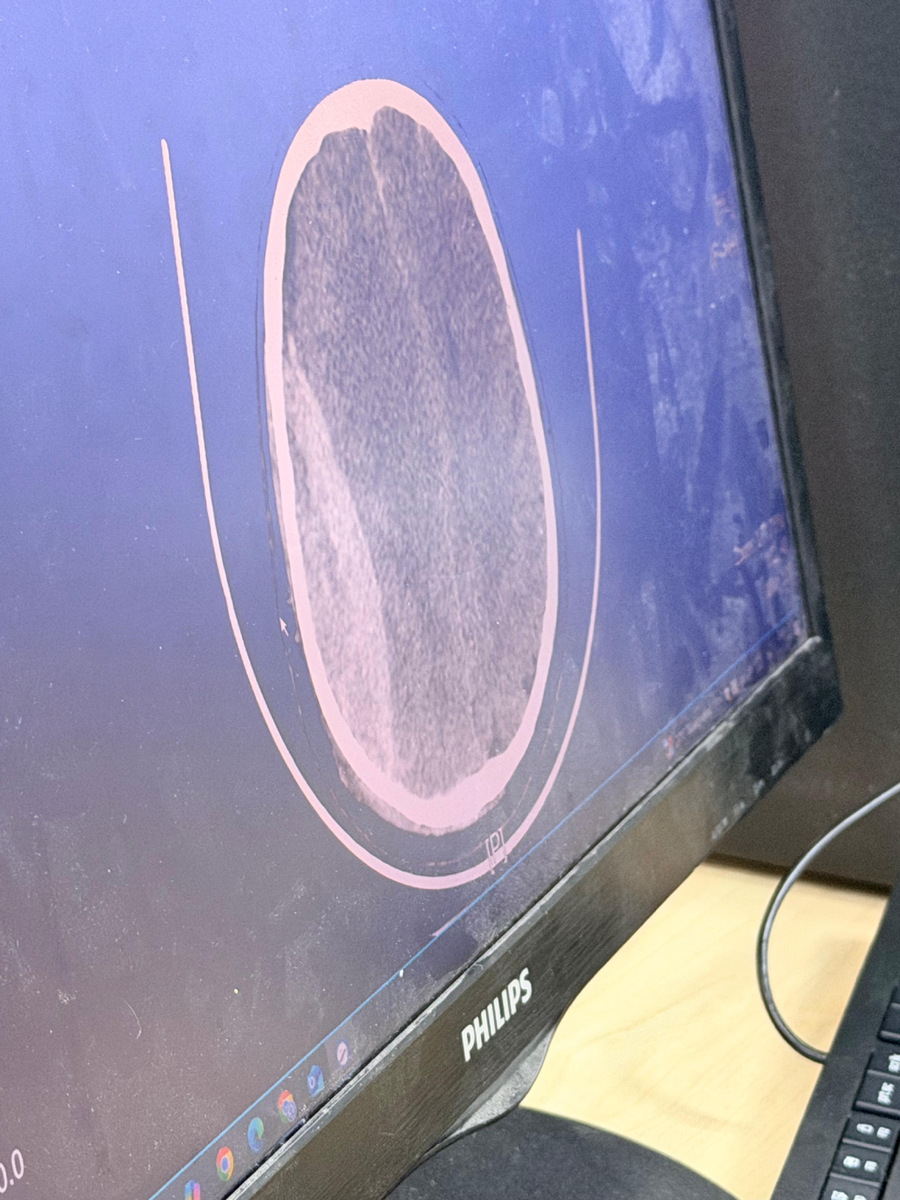 Светлый сегмент  на снимке   - это  кровь.