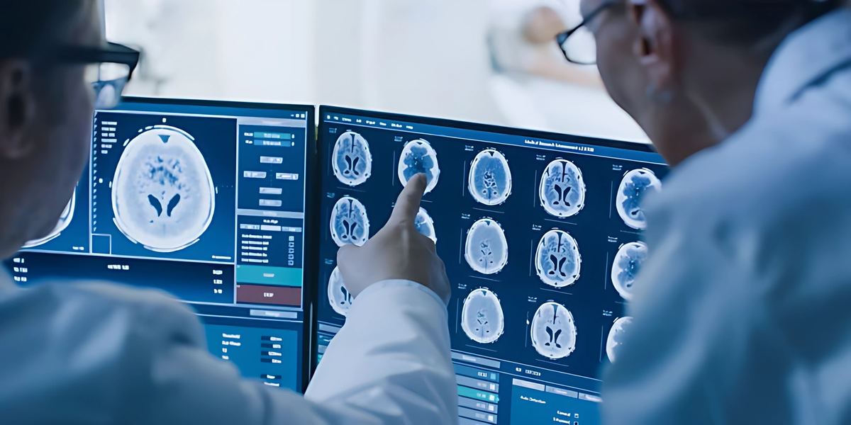    Засорение «дренажных систем» мозга, которое можно увидеть на МРТ, может быть ранним признаком болезни Альцгеймера — еще до того, как начнется потеря памяти.