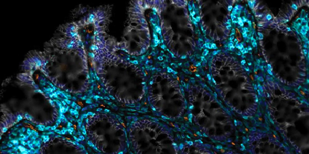 Как восстановить стареющий кишечник: ответ ученых