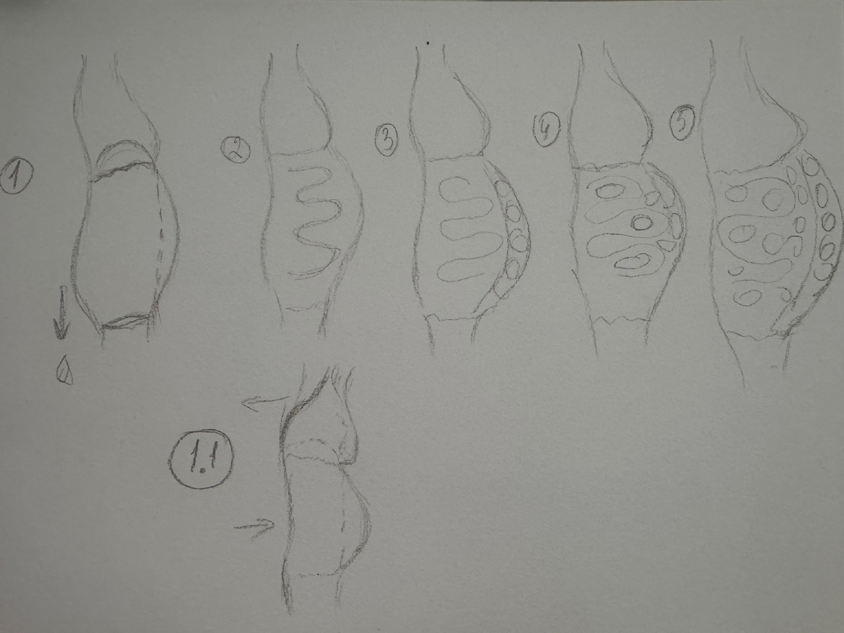 Вы могли видеть эту картинку у меня в телеграм, когда я анонсировала спринт по уменьшению живота, который уже второй день идет. У нее получается был тип 3 + деформация позвоночника. Если кому интересно, самые опасные - это четыре и пять. 