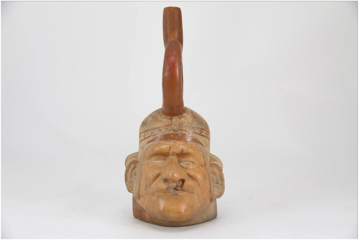 Изображение слепого мужчины с глубокой расщелиной губы.
