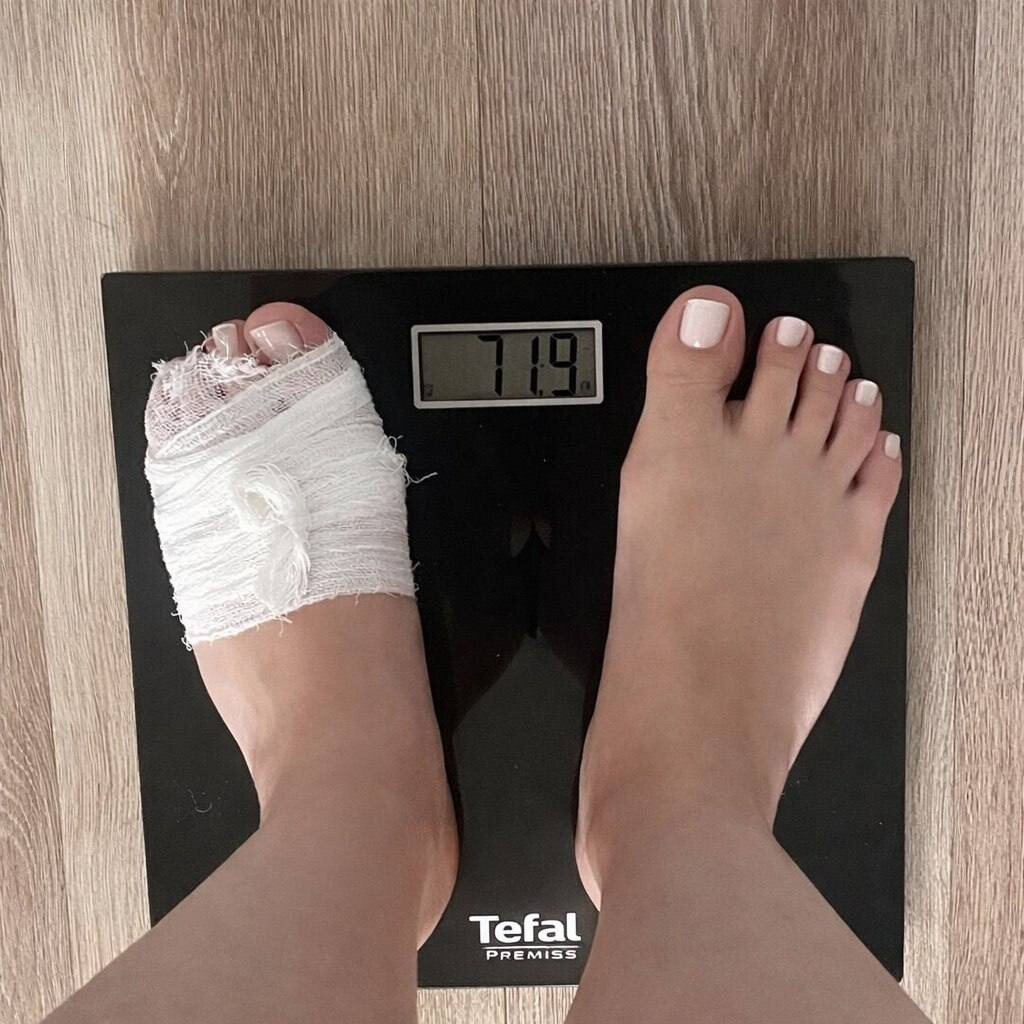 На забинтованную ногу не обращайте внимание, наступила на стекло