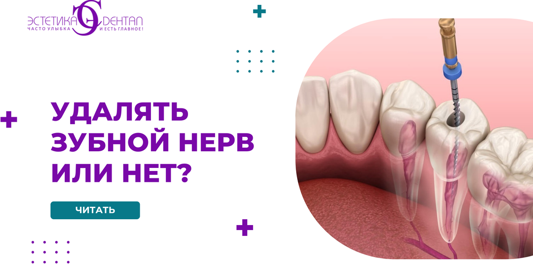 Обязательно ли удалять зубной нерв или его можно сохранить?