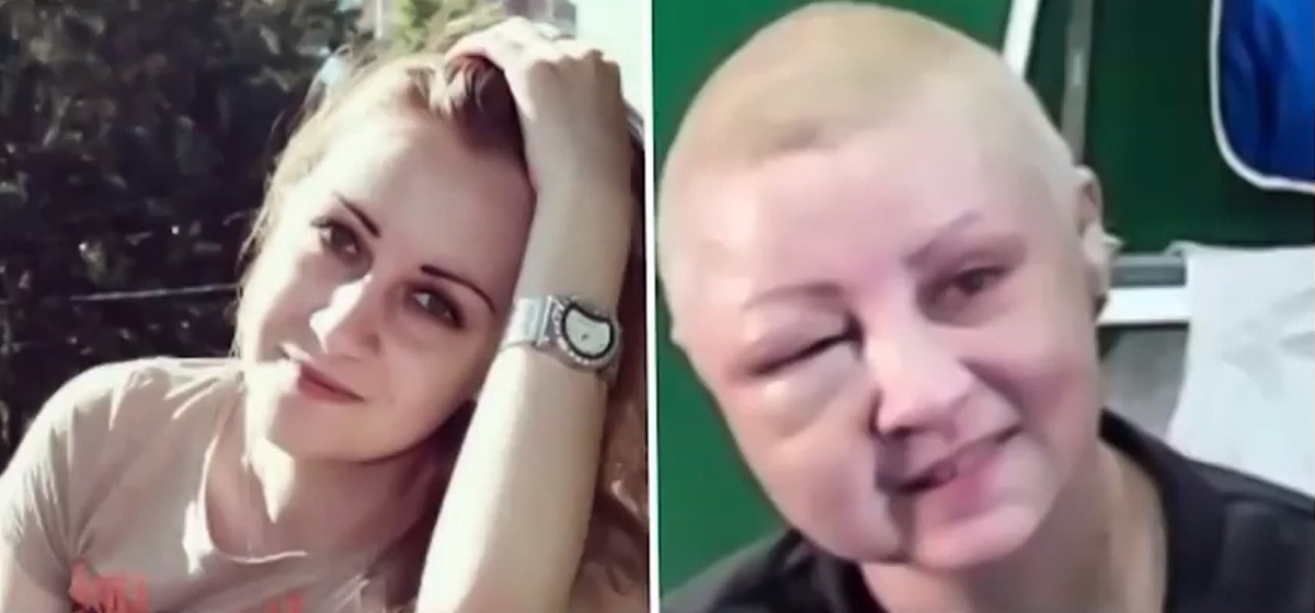 До и после стримов