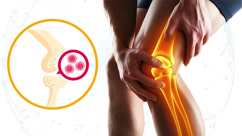 Прорыв в лечении артрита: "Укол от старости" заставил хрящ в колене расти заново