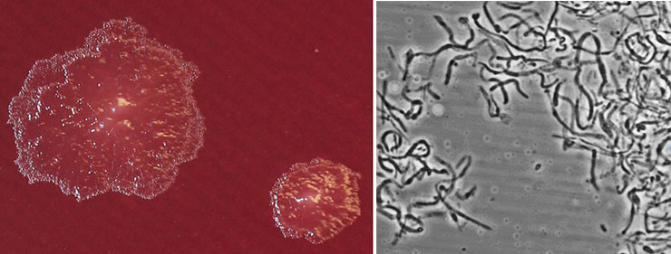 Палочковидные бактерии рода Turicibacter чаще всего обнаруживаются в кишечнике животных, обычно в ассоциации с другими полезными бактериями. Слева – бактериальные колонии, справа – бактерии под микроскопом. © CC BY-SA 4.0 /Tommy Auchtung