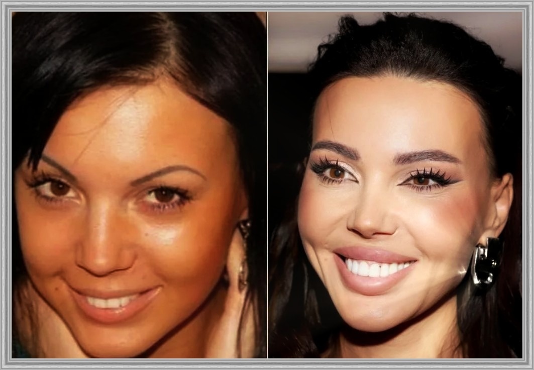 Задумывался ли кто-то, что наша культура красоты стала своеобразной ловушкой, где ценят не личность, а соответствие шаблону?
