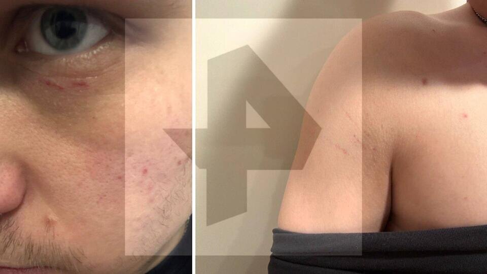     Силовики избили корреспондента РЕН ТВ во время рейда на фестивале в Москве РЕН ТВ