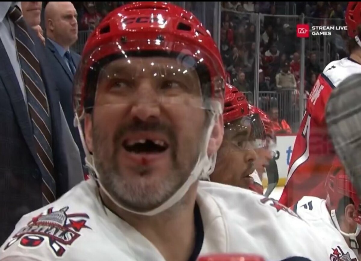     Вашингтонский журналист: Овечкин снова лишился зуба — это уже было хорошим знаком