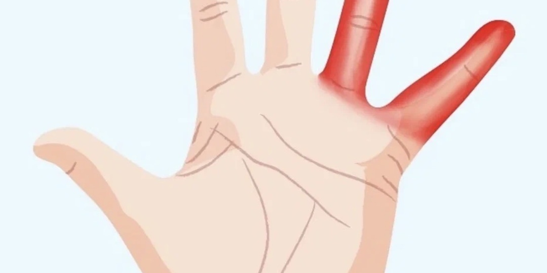 Массаж двух пальцев рук, который точно пригодится вечером