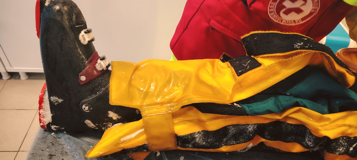 Шина накладывается внахлёст на ботинок до тазобедренного суства. При травме голени нахлёст должен быть больше.  