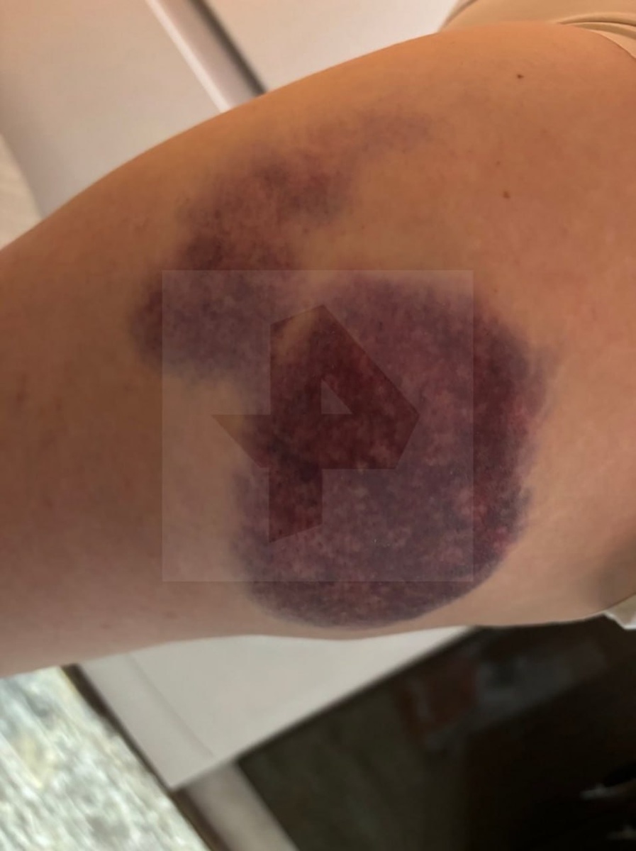    Пассажирка перевернувшегося в Карелии судна на воздушной подушке рассказала о неадекватном водителе© РЕН ТВ/ коллаж Столица на Онего