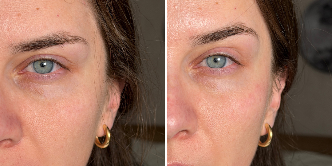 Как за 10 минут "сдуть" лицо от отечности: показываю проверенную опытом маску