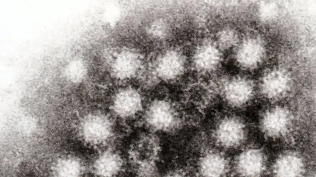    Норовирус © wikipedia.org