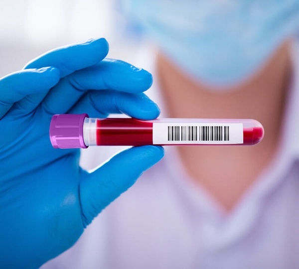 Общий анализ крови: о чем он говорит?