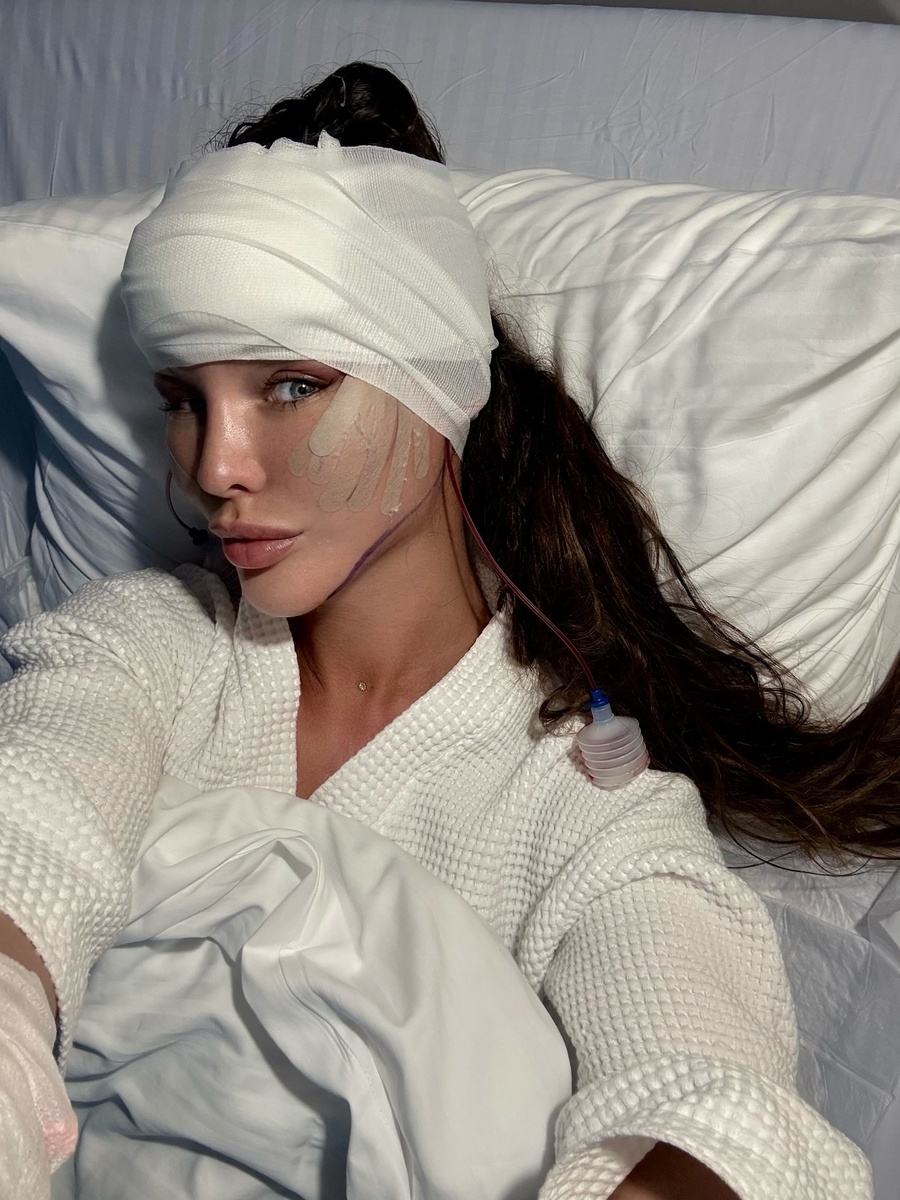    Светлана Сильваши после пластики лицаСоцсети Светланы Сильваши