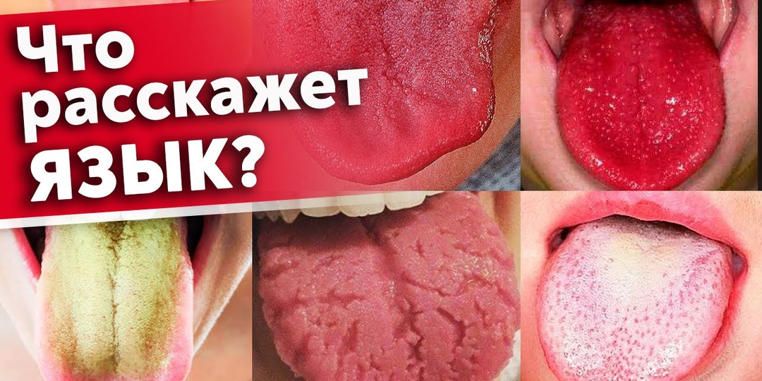 Язык предупредит вас о болезнях! Как диагностировать состояние организма по языку?