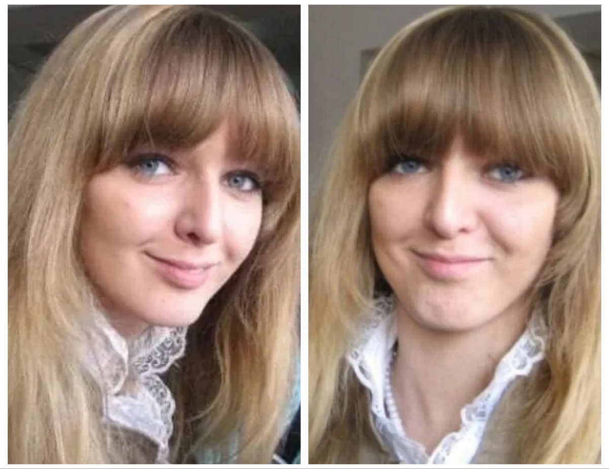 Светлана до пластики 